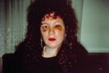 Nan one month after being battered 1984 Nan Goldin born 1953 Purchased 1997 http://www.tate.org.uk/art/work/P78045